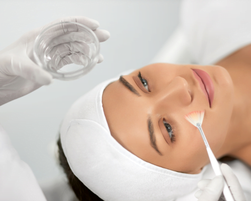 Chemical Peel