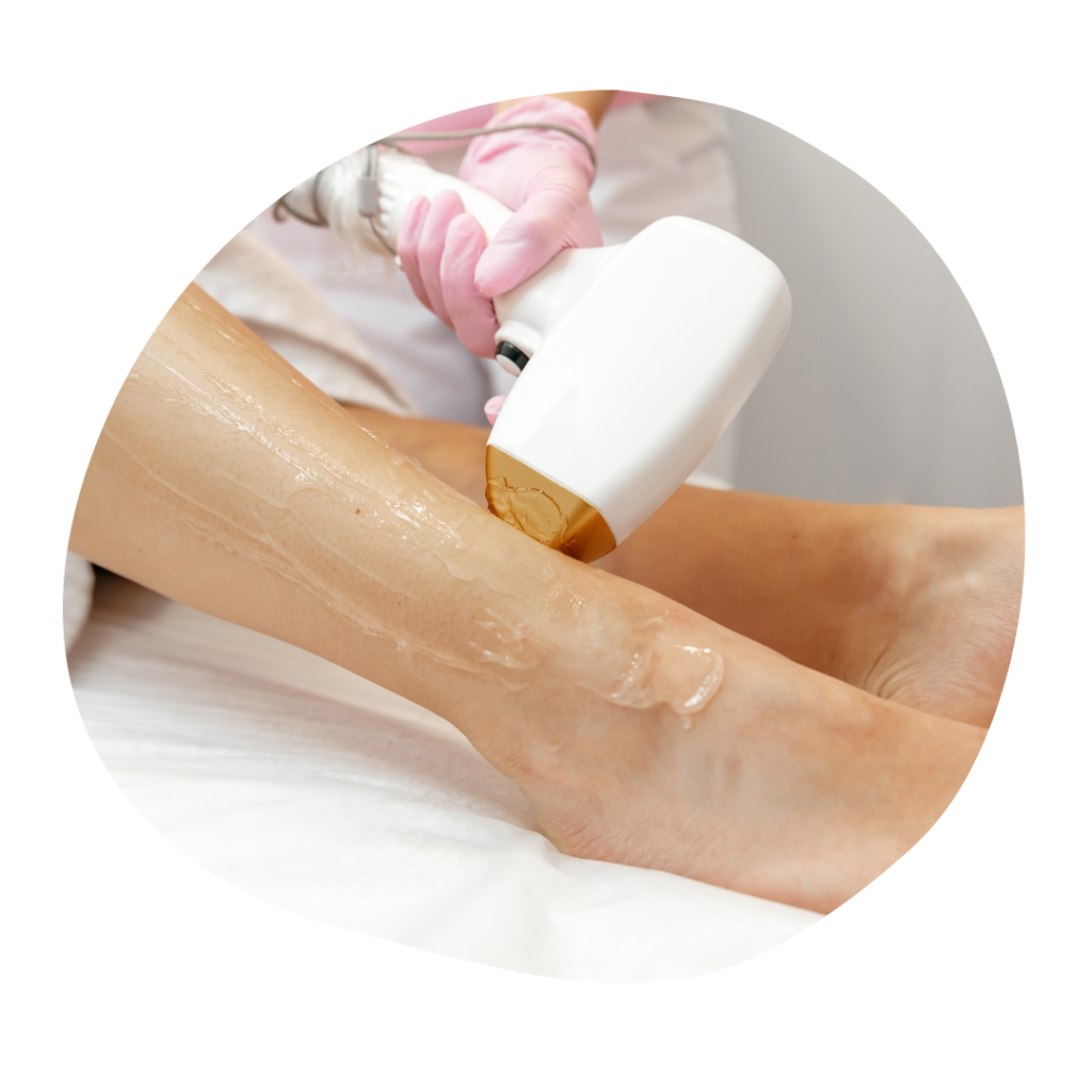 Hair removal Laser treatment in Udaipur